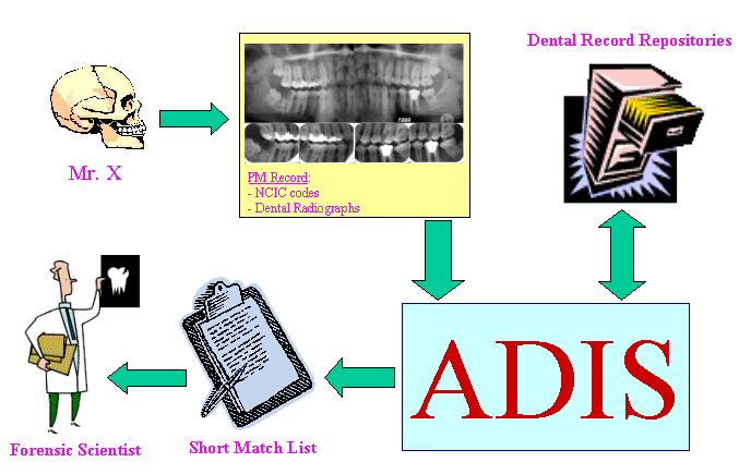 Système automatique d'identification de la dentition