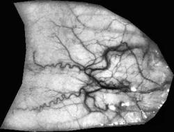 eye vein